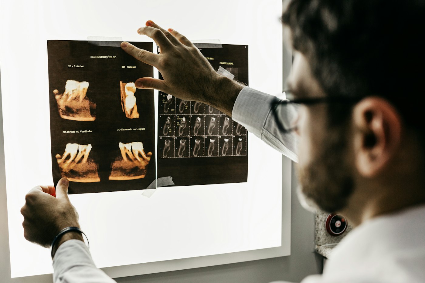 Digital X-rays